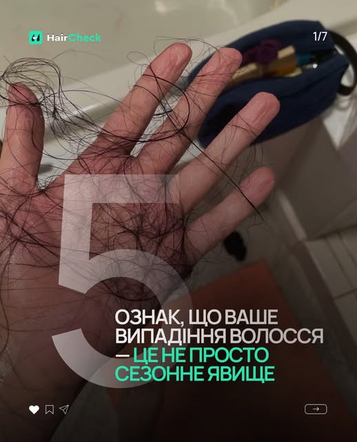 З приходом осені волосся почало випадати сильніше, і ви думаєте, що це сезонне явище? 

Тримайте чек