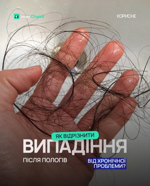 Пацієнтки, які народжували, часто звертаються до нас з питанням: після пологів волосся почало випада