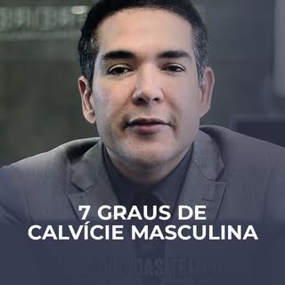 A calvície é uma realidade para muitos homens hoje em dia. Neste vídeo, explico detalhadamente os se