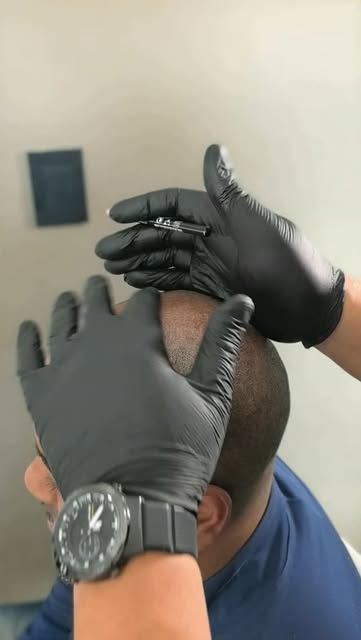 #scalpmicropigmentation #southafrica #hairtransformation #menhealth #fyppppppppppppppppppppppppppppp
