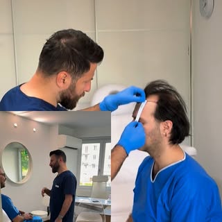 Swiss Quality Hair Transplant Experience in Zurich 🇨🇭
From personalized hairline design to long-te