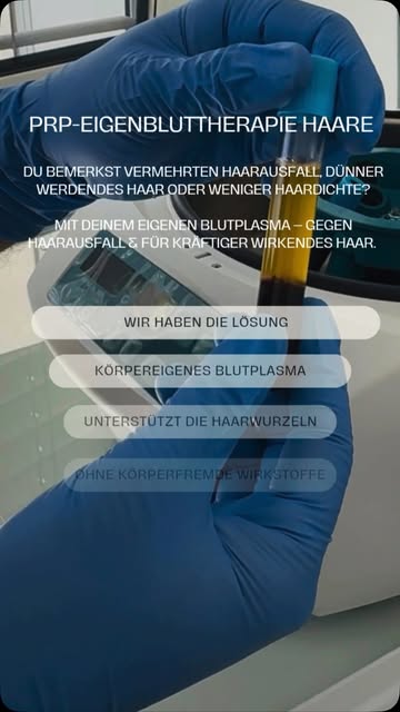 PRP-EIGENBLUTTHERAPIE HAARE | PRP - TREATMENT HAIR
• Kostenlose ärztliche Beratung inkl. HairScan bu