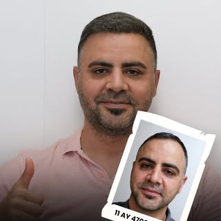 Hair loss impacts more than just appearance — it can significantly affect self-confidence. When perf
