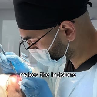 If you’re thinking about having a hair transplant, here are 3 questions I think every patient should
