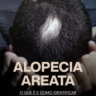 Percebeu falhas no couro cabeludo, barba ou sobrancelhas? Procure um dermatologista.

Agende sua con