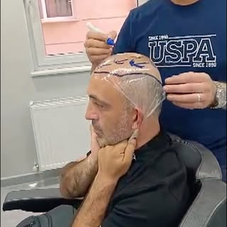 Doğallığın yeni seviyesi!
A kalite protez saç uygulamamız ile tamamen doğal görünüm, güçlü tutuş ve 