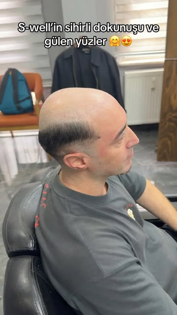 Doğallığın yeni seviyesi!
A kalite protez saç uygulamamız ile tamamen doğal görünüm, güçlü tutuş ve 