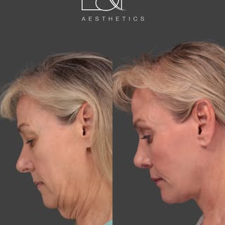 A beautiful, natural-looking transformation that will continue to evolve with time.

It’s important 