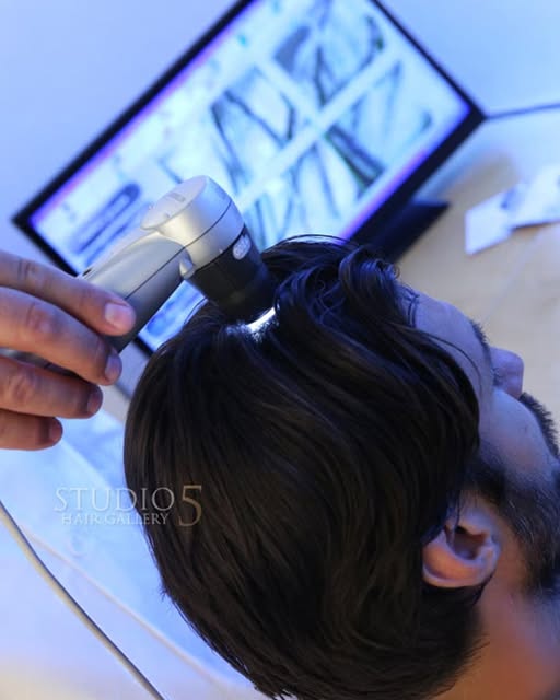 CRLAB Trichological Hair Treatments help men and women address the common, underlying scalp problems
