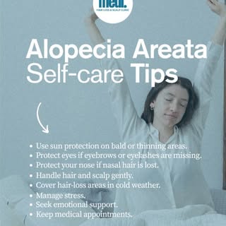 Today is International Self-Care Day. If you’re living with alopecia areata, today is a good reminde