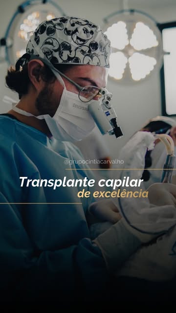 Transplante capilar não é só sobre quantidade de fios. Planejamento, técnica e avaliação individual 