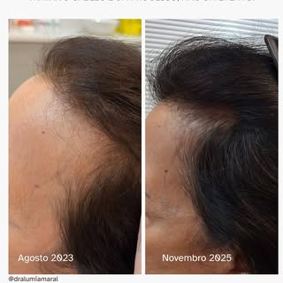 ✨ O tratamento de pacientes com condições crônicas de couro cabeludo não é uma foto de um único mome