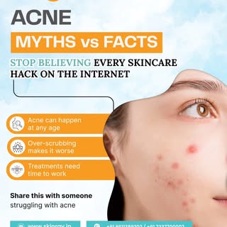Not every skincare hack online is helping your skin.
Acne needs the right care, patience, and expert
