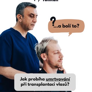 Vždycky, když jsem někomu řekl, že jsem byl na transplantaci vlasů, všichni se ptali: „...a bolí to?