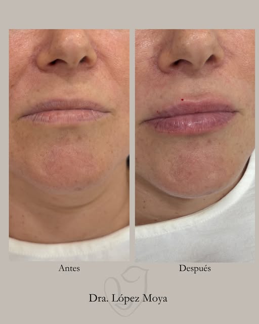 ¿Tu también quieres unos labios más hidratados, con volumen y sobre todo que no se noten? 👄

Pues e