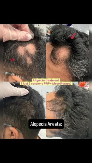 ✨ Skin • Hair • Laser Treatments Available ✨
Complete care for your skin, hair & laser concerns at D
