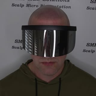 3rd and final session of scalp micropigmentation hair tattooing for this kind gent, it was a real pl