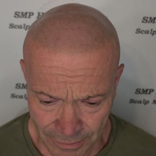 After originally giving my client his SMP, now after a top up, his healed work still looks amazing.

