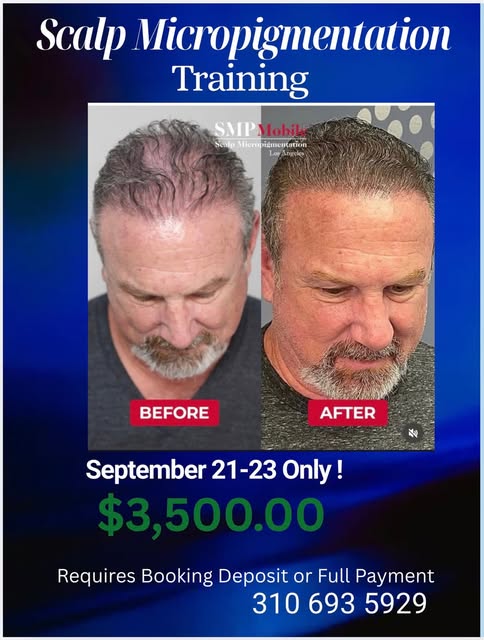 Get trained for SMP and watch it change your life. This training comes with a professional kit and c