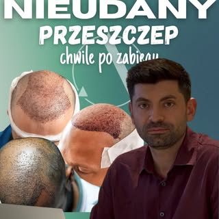 Jak rozpoznać nieudany przeszczep tuż po operacji? Posłuchaj, co lekarz ma do powiedzenia na temat z
