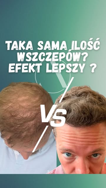 Jeżeli chcecie więcej takich materiałów to zostaw like i komentarz aby zachęcić do nagrywania takich