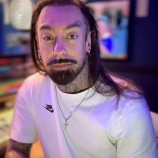 Você sofre com a calvície?
Até os artistas fazem esse procedimento... Nosso cliente e  DJ Dimy Soler