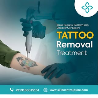 Ready to let go of that old tattoo? 
Our safe and effective laser treatment helps you say goodbye to
