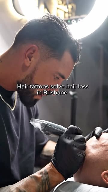 Tired of hair loss? Let us fix it with a hair tattoo! Scalp Micro Pigmentation is one of Brisbane’s 