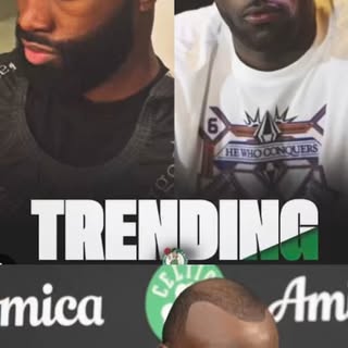 Listen man, if you wanna get your hair back, STOP PLAYING and come see me! No Turkey 🇹🇷 real resul