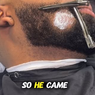 OH my God! BRO IS COOKED 😳😳 DID I SAVE HIM? #hairrrstorationspecialist #hairreplacementsystem