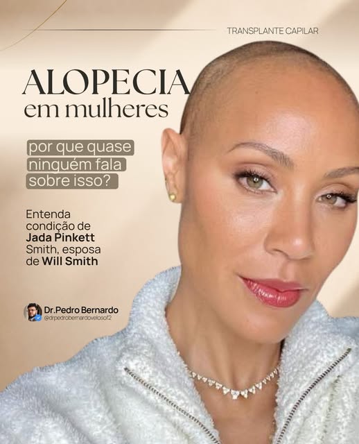 Quando Jada Smith falou publicamente sobre a alopecia, muitas pessoas passaram a ouvir sobre uma con