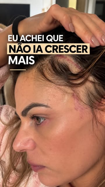 Eu achei que esse cabelo não fosse mais crescer.

Nunca tinha mostrado essa parte por aqui.

Depois 