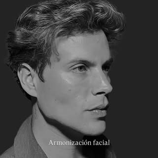 ✨Armonización facial a nuestro paciente @riversonworld 💉✨

Nuestro paciente partía de muy buena est