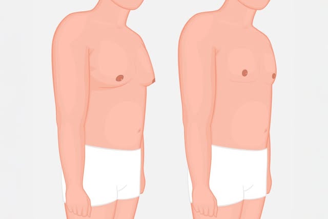 Why more men are choosing subtle cosmetic enhancement in Westchester County. https://bit.ly/4g5U04T 
