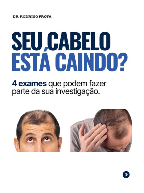 Queda de cabelo não tem uma única causa. E é justamente por isso que a investigação não deveria come