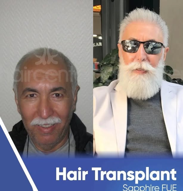 Before ➡️ After  The difference between the before and after lies not only in appearance but also in