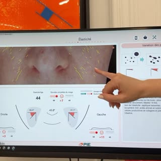 Chaque peau est unique. C’est pourquoi chaque traitement doit commencer par un diagnostic précis.

G