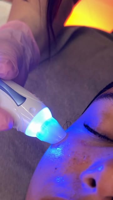 L’InPure associe un nettoyage en profondeur à une infusion transdermique pour prendre soin de la pea