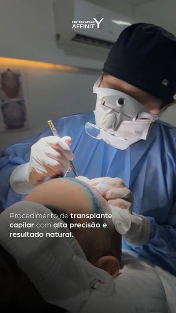 Alta performance em cada detalhe. 🔬✨

O transplante capilar é uma união entre arte e medicina. No v