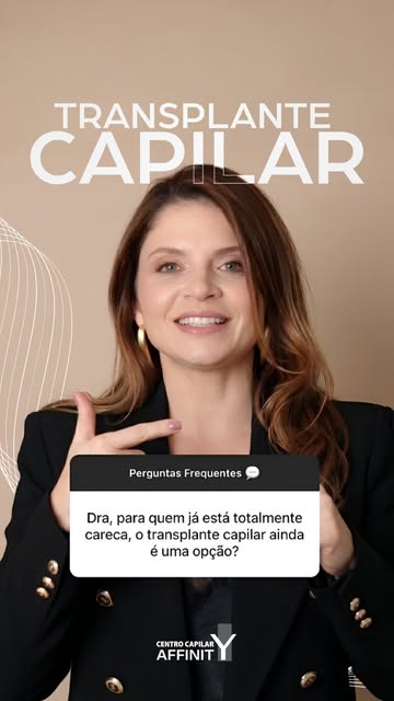Você sabia que esperar o grau máximo da calvície pode dificultar o seu resultado? 

Muitas pessoas a