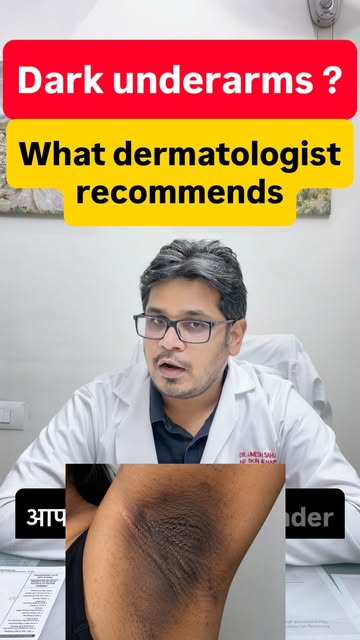 #dermacliniquemohali #dermatologist #skintreatment #dark underarms  Dark Underarms (Underarm Pigment