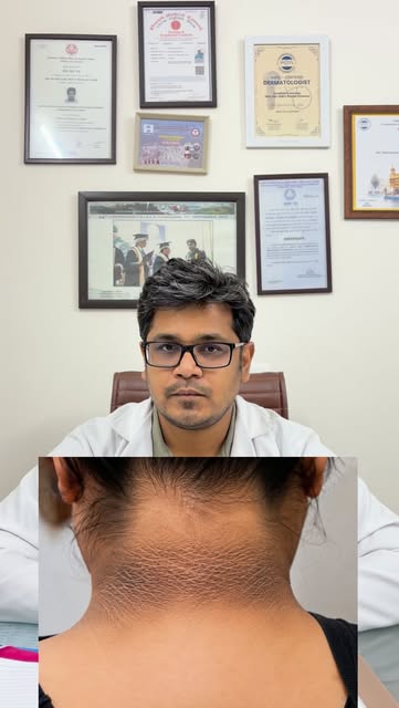 #black neck #acanthosis #dermatologist #kaligardanjailaj #mohaliclinic