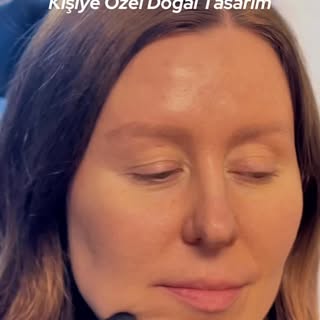 #augenbrauentransplantation #augenbrauen #haartransplantationtürkei #haartransplant #deutschland