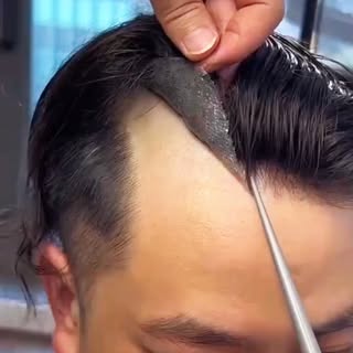 Instant confidence unlocked! 🔓 Watch this complete hair patch transformation and see how flawless a