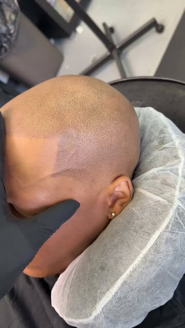 What do you all think of this permanent bald taper and line up I gave my Alopecia client! Fresh cut 