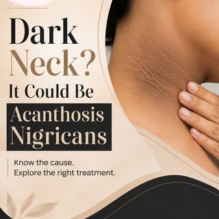Dark neck? It might be more than just pigmentation. 👀

A dark, velvety neck can sometimes be a sign