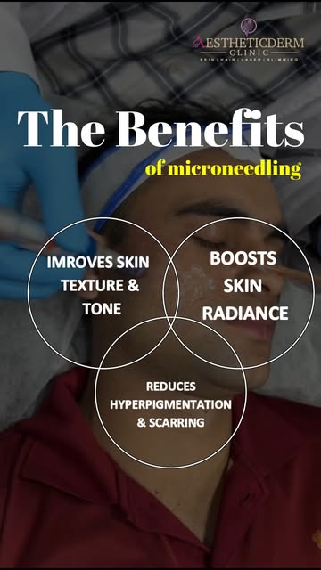 ✨ Microneedling for smoother, brighter, more radiant skin!
From improving skin texture and tone to r