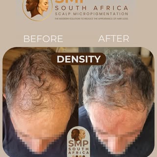 Reduce the appearance of hair loss with the ultimate modern hair density solution. 🙌

_____________