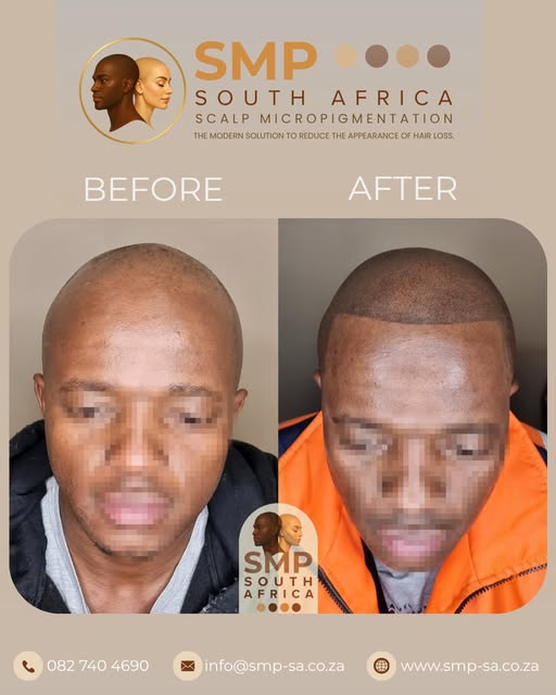 Real results speak for themselves. Say goodbye to thinning hair and hello to a sharp, natural hairli