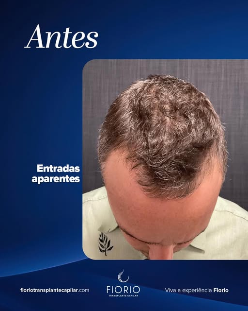 Resultado que fala por si.

O antes e depois mostra mais do que uma mudança visual: mostra um proces